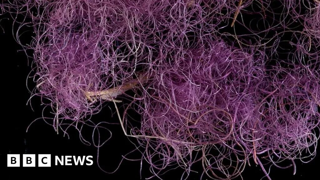 Пурпура симптомы фото Israeli archaeologists find 'Biblical royal purple dye' - BBC News