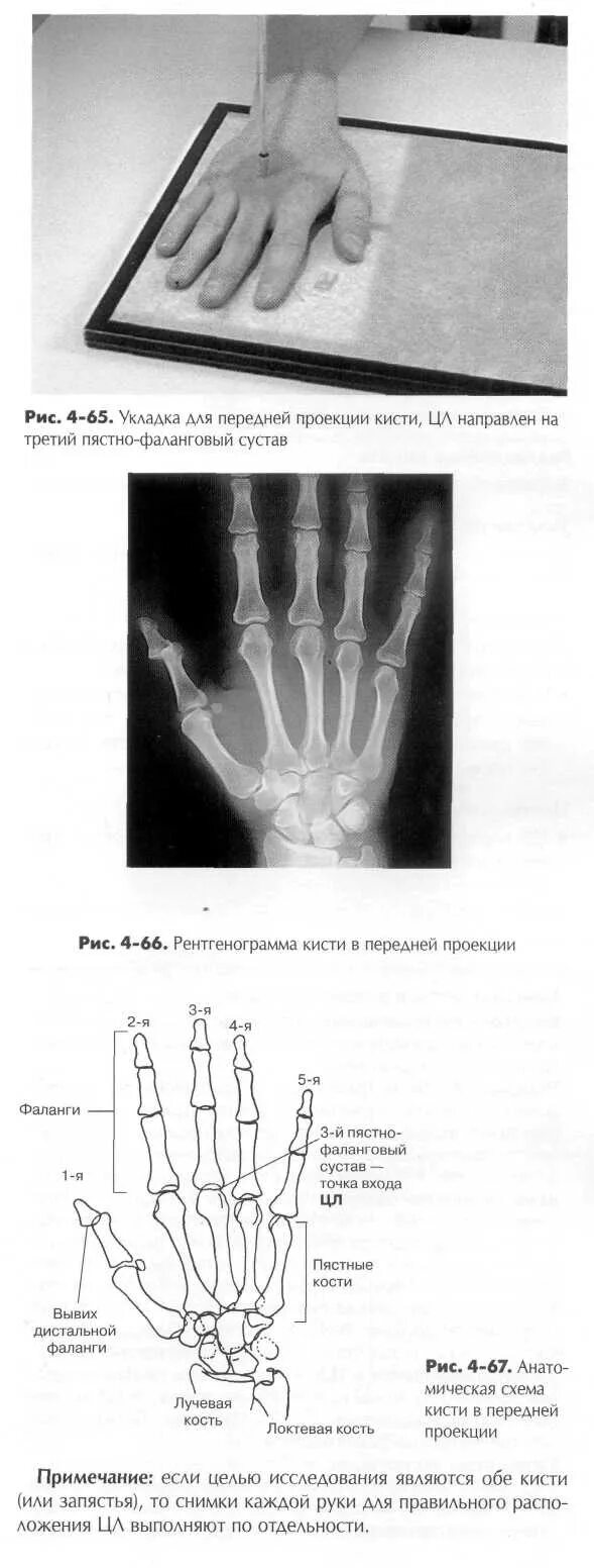 Пястная кость кисти фото Сколько пястных костей: найдено 90 изображений