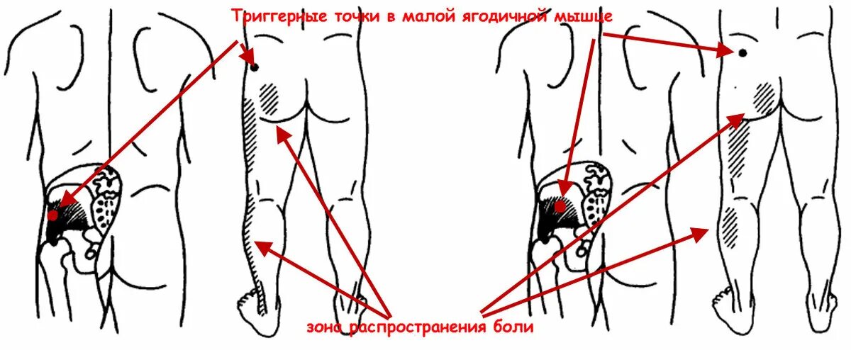 Пятая точка фото Картинки С ПОЯСНИЦЫ ОТДАЕТ В ЛЕВУЮ НОГУ