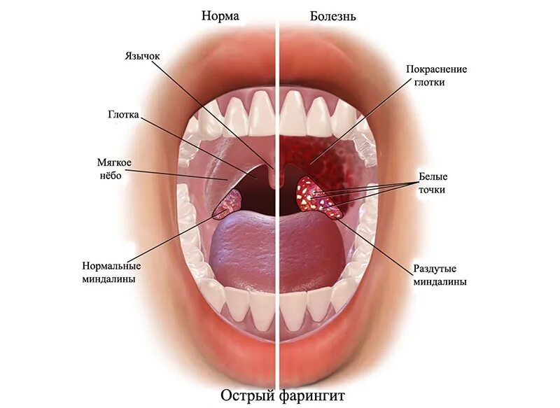 Картинки на небе красные пятна (69 фото)