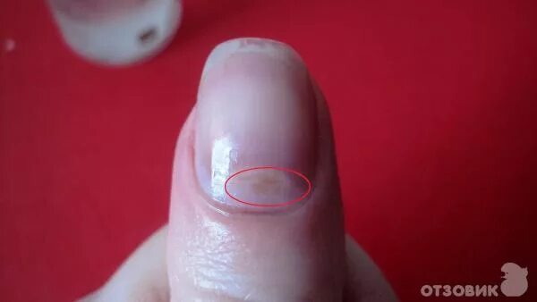 Пятно на ногте ног фото Отзыв о Умная эмаль Frenchi Nail Builder "Восстановитель поврежденных ногтей" Ср