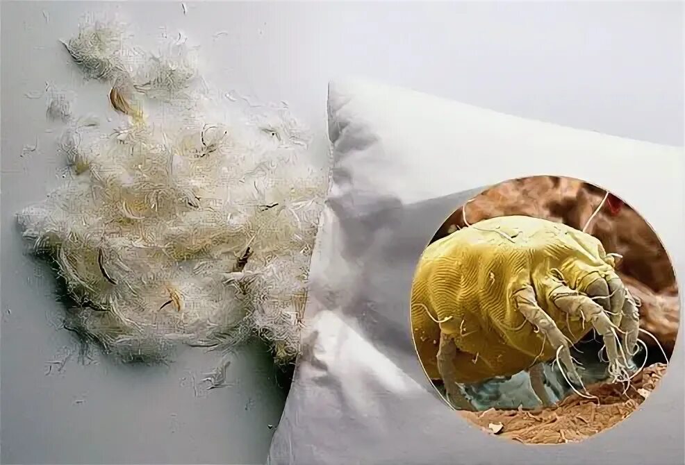 Пылевой клещ аллергия фото How to Get Allergy Relief at Home Cleaning pillows, Dust mites, Pillows