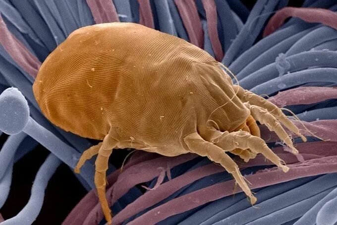 Пылевой клещ фото под микроскопом 7 Ways to get rid of dust mite allergy Dust mite allergy, Dust allergy, Allergie