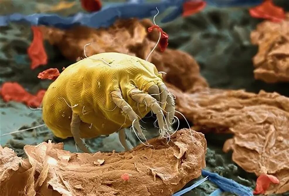 Пылевой клещ фото под микроскопом The house dust mite, you have thousands of these little dudes in your mattress..