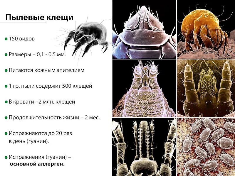 Пылевые клещи аллергия на коже фото Комментарии пользователя K0rnel на форуме акций / sMart-lab.ru - блоги трейдеров