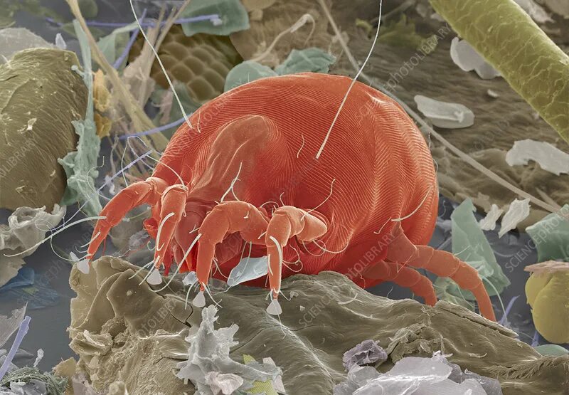 Пылевые клещи фото под микроскопом на постели Dust mite, SEM - Stock Image - Z445/0326 - Science Photo Library