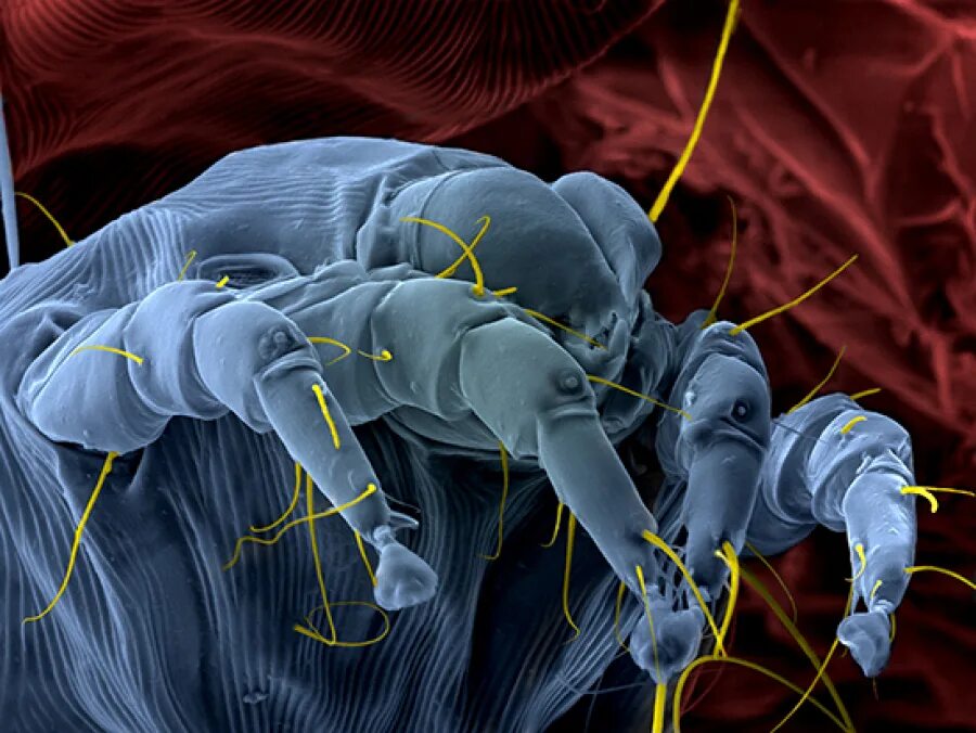 Пылевые клещи фото под микроскопом на постели How LPS prevents or promotes development of asthma and allergic disease by airbo