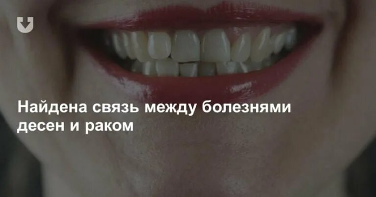 Рак десны начальная стадия симптомы фото Рак десны: симптомы, причины, диагностика, лечение и прогноз