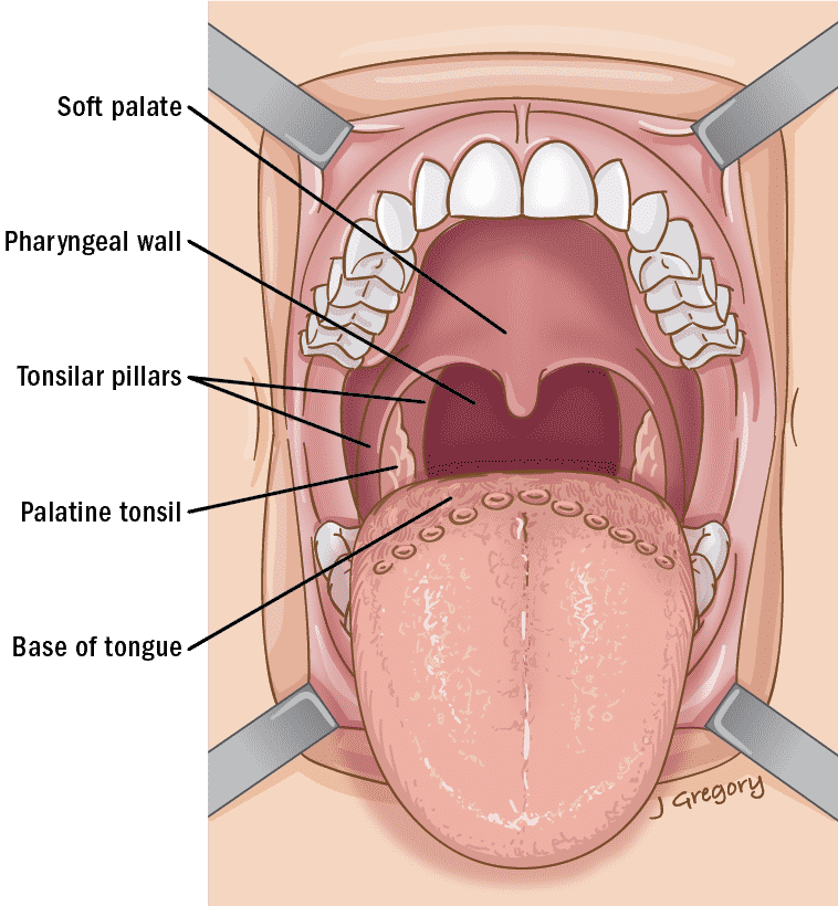 Рак глотки первая стадия фото Oropharyngeal Cancer Anatomy * THANC Guide