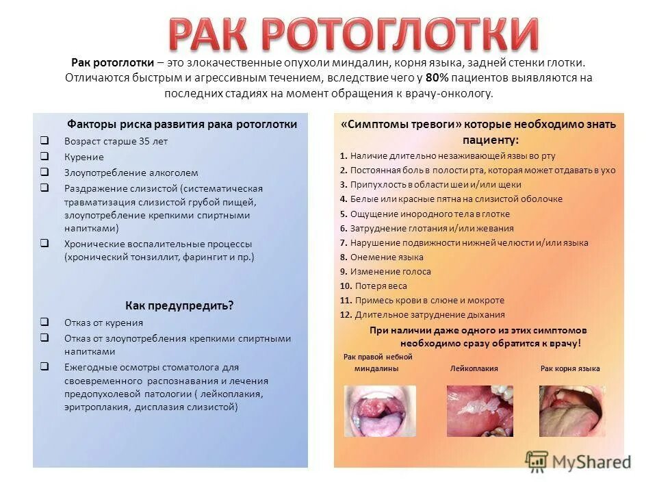 Рак горла фото Информационные материалы по раннней диагностике новообразований полости рта и гл