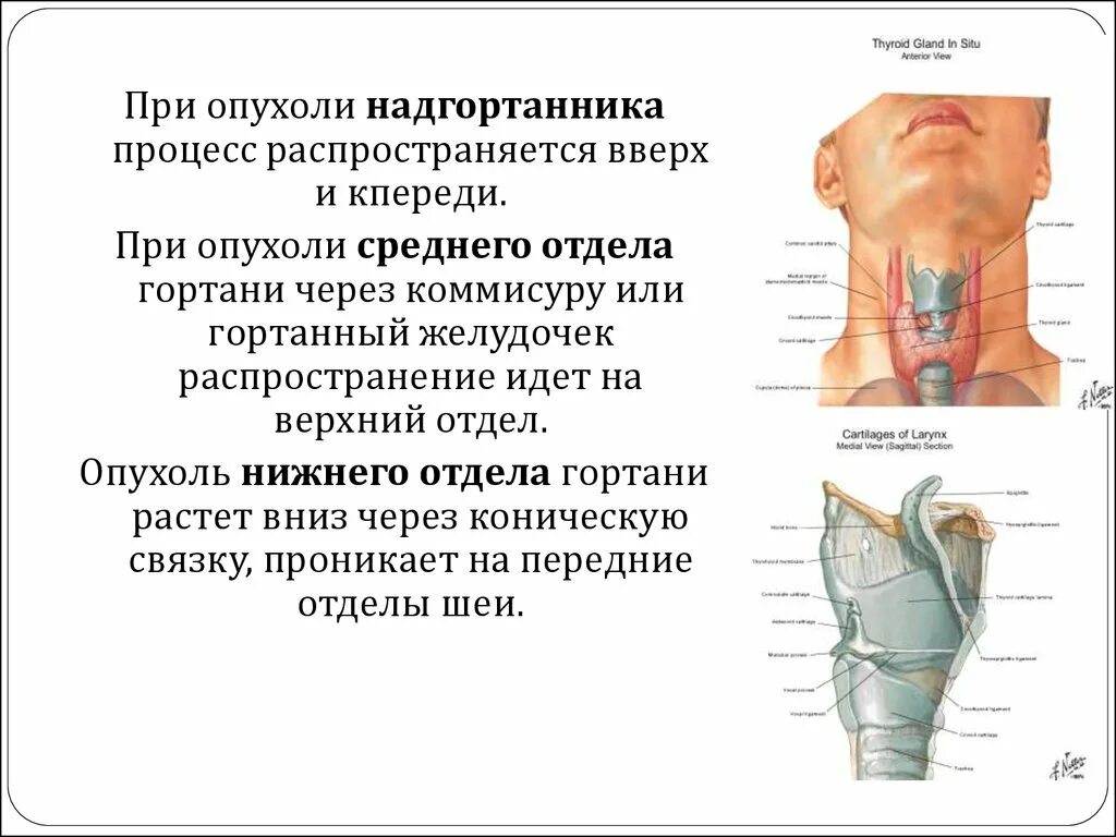 Рак горла фото и описание Болит гортань причины