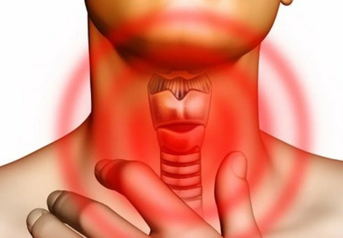 Рак гортани симптомы горла фото Treatment of diseases and pathologies of the larynx and pharynx