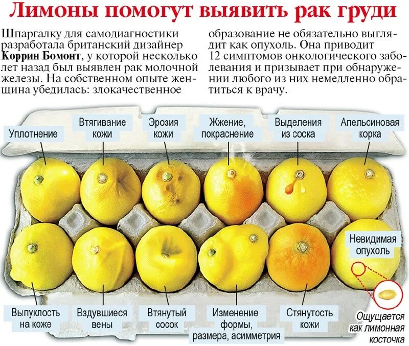 Рак груди 4 стадия фото распад Профилактика рака молочной железы Клиника "Я здорова!