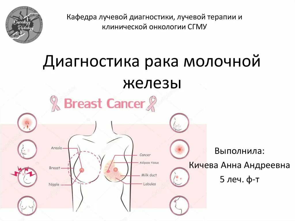 Рак груди симптомы на ранней стадии фото Диагностика рака молочной железы - online presentation