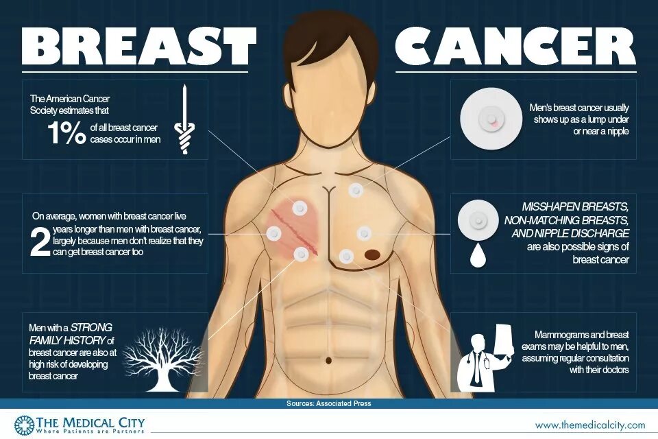 Рак груди у мужчин симптомы признаки фото Breast cancer in men Edge Davao