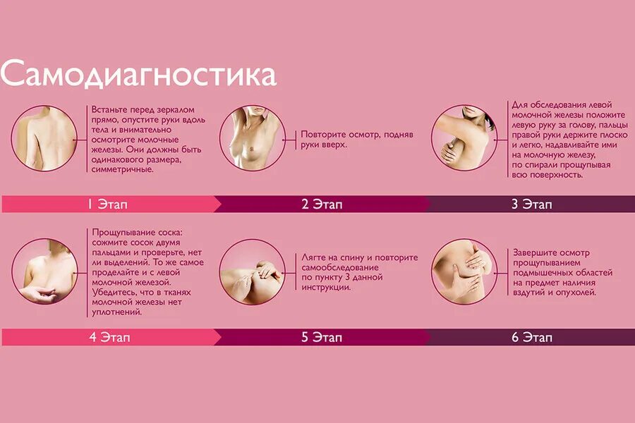 Рак груди1 стадии фото ГБУЗ СО "Самарская городская клиническая больница № 2 имени Н.А. Семашко" Новост