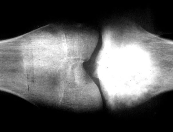 Рак костей фото Научные и околонаучные новости ВКонтакте