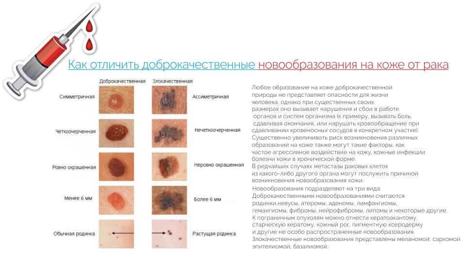 Рак кожи лица признаки фото Рак кожи: меланома, базалиома и другие - 1 Августа 2018 - Земля - Хроники жизни