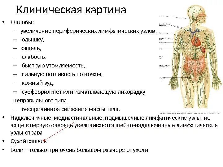 Рак лимфатической системы фото Картинки ЛИМФАТИЧЕСКИЙ УЗЕЛ СИСТЕМА ОРГАНОВ