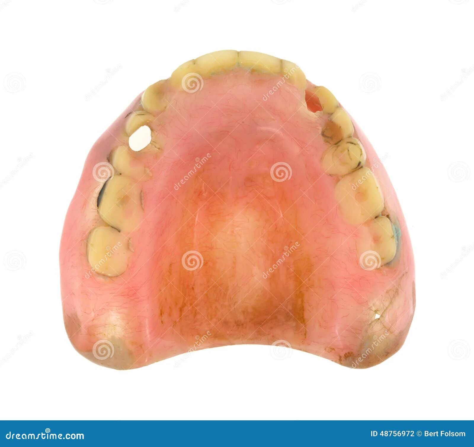 Рак мягкого неба фото Top View Worn Denture Teeth Stock Photo - Image of worn, dental: 48756972