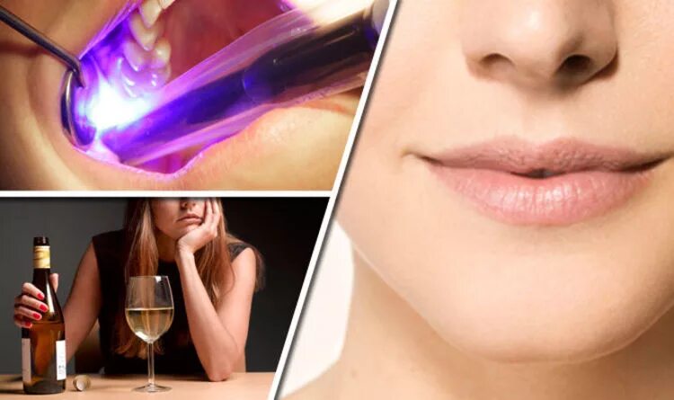 Рак неба фото и признаки Mouth cancer symptoms revealed: Nine signs YOU could have the disease Express.co