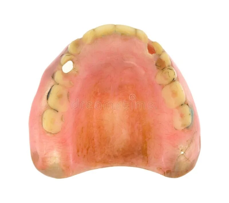 Рак неба во рту фото Top View Worn Denture Teeth Stock Photo - Image of worn, dental: 48756972