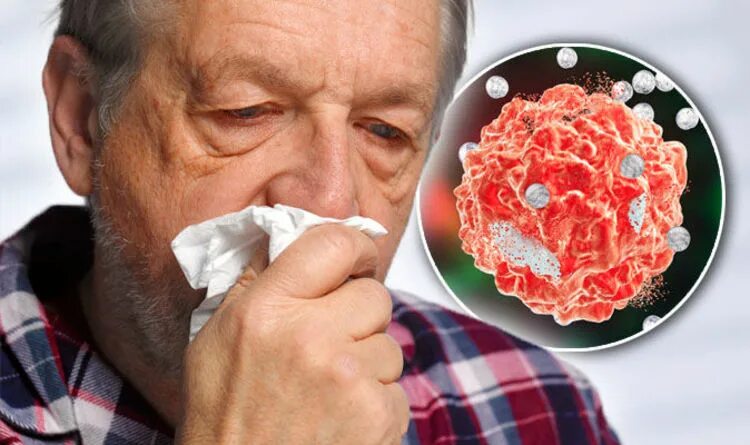 Рак носа симптомы и признаки фото Cancer symptoms: Signs of tumour include blocked nose - cold virus symptoms Expr