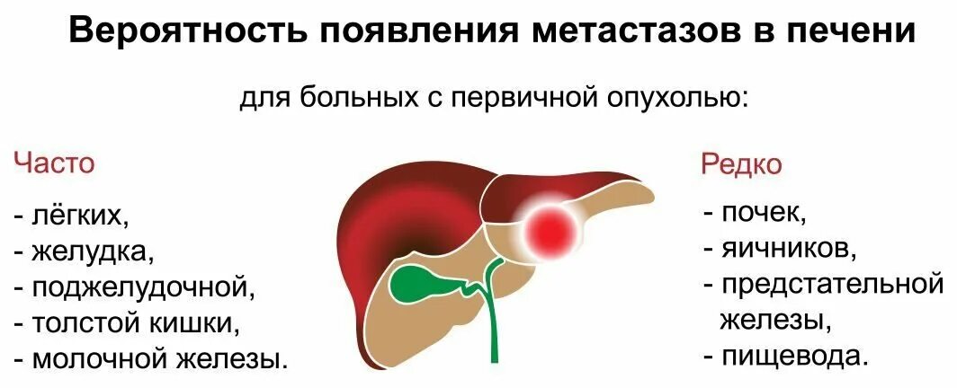 Рак печени 4 стадия фото Опухоли в печени - что это может быть и насколько опасно Наш дом в Новороссийске