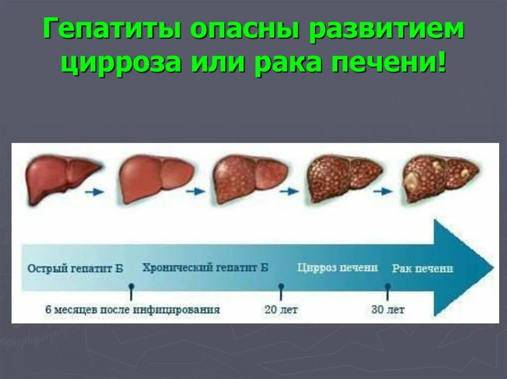 Рак печени фото больных Смертельный враг: рак печени и его разрушительное воздействие