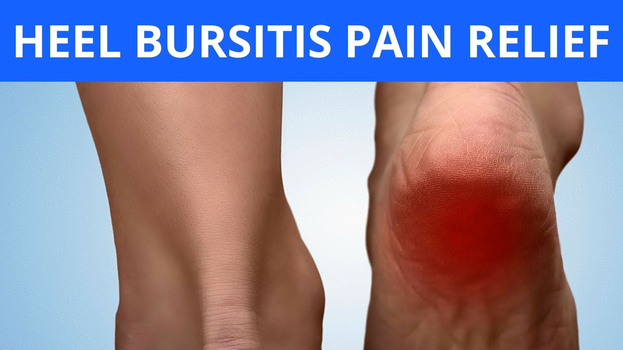 Рак пятки симптомы фото Heel Bursitis Pain Relief - YouTube