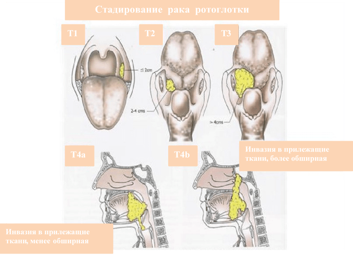 Épinglé sur Head and Neck