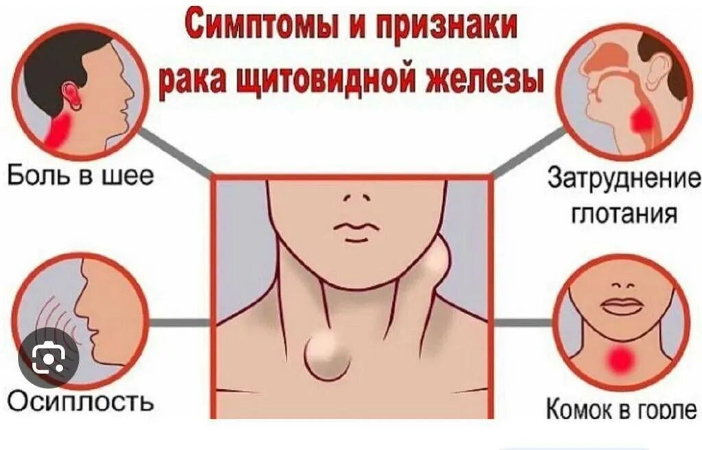 Рак щитовидной железы симптомы у женщин фото Заболевание щитовидной железы / Новолакская РБ № 1