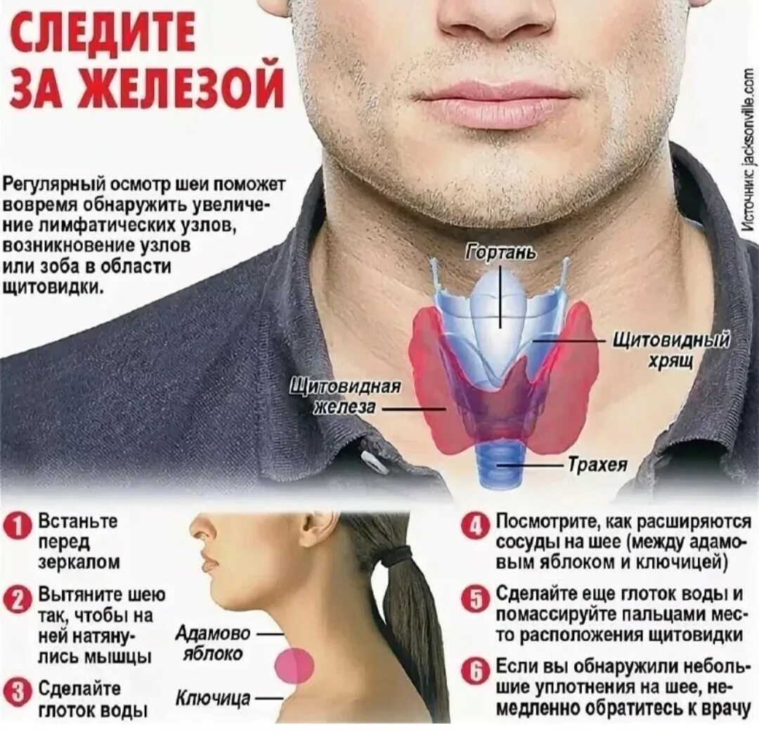 Рак щитовидной железы симптомы у женщин фото Неправильная работа желез: найдено 78 картинок