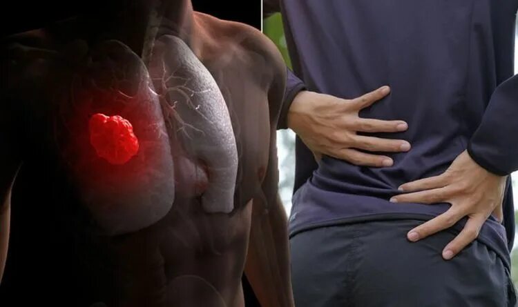 Рак сердца фото Lung cancer symptoms: Signs of a tumour include unexplained back pain - when to 