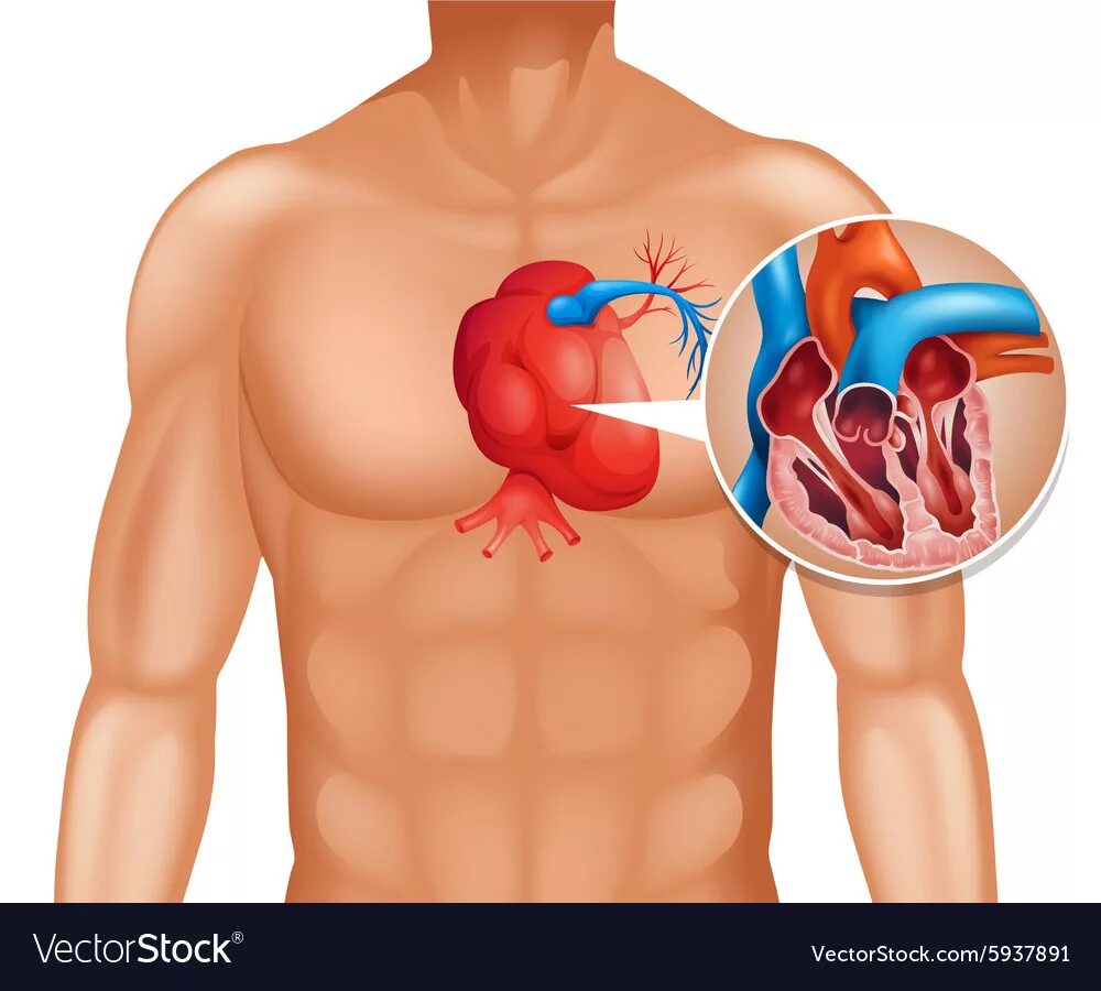 Рак сердца фото Heart cancer in human Royalty Free Vector Image