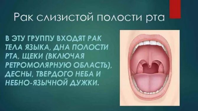 Рак слизистой рта симптомы фото Режущая боль в горле с одной стороны - причины и лечение 2020