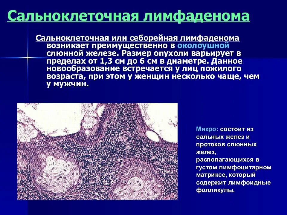 Рак слюнных желез симптомы фото Заболевания слюнных желез - презентация