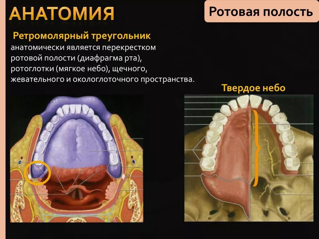 Рак твердого неба фото КТ-диагностика злокачественных опухолей ротовой полости, глотки, гортани