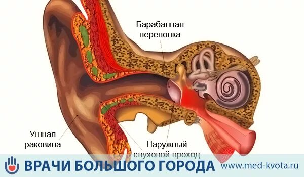 Рак среднего уха. Врач-онколог Чачух Азамат Заурович Дзен