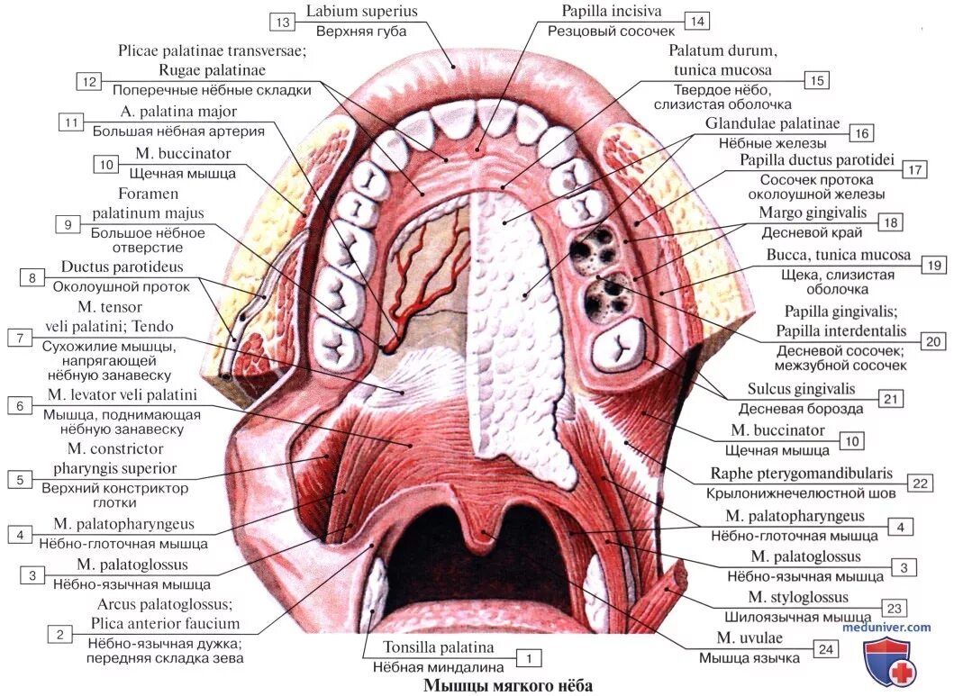 Рак верхнего неба фото во рту Анатомия: Нёбо, palatum. Твердое небо. Мягкое небо