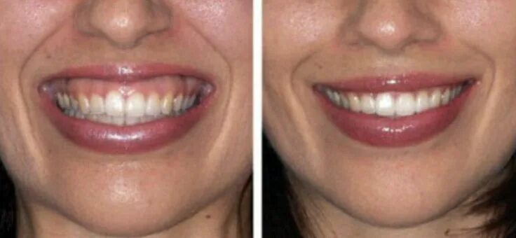 Рак верхней десны фото Parsa T. Zadeh, DDS Dentist In Beverly Hills, CA Botox, Vaseline beauty tips, Bo