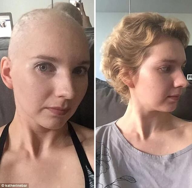 Рак волос фото Cancer survivors post transformation photos on Bored Panda Daily Mail Online