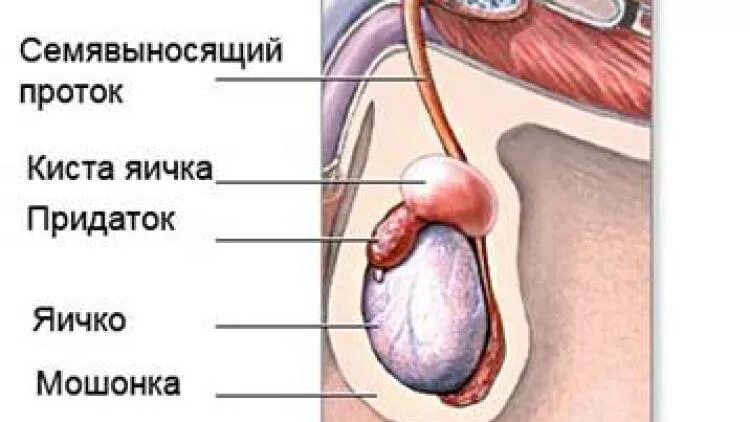 Рак яичка фото снаружи Рак яичка: причины, первые признаки и симптомы