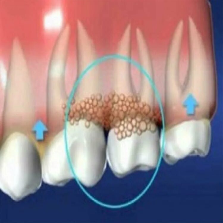 Рак зуба симптомы фото Clínica Dental Prodent S. R. Ltda, dental clinics, Peru, Lima, Avenida Javier Pr