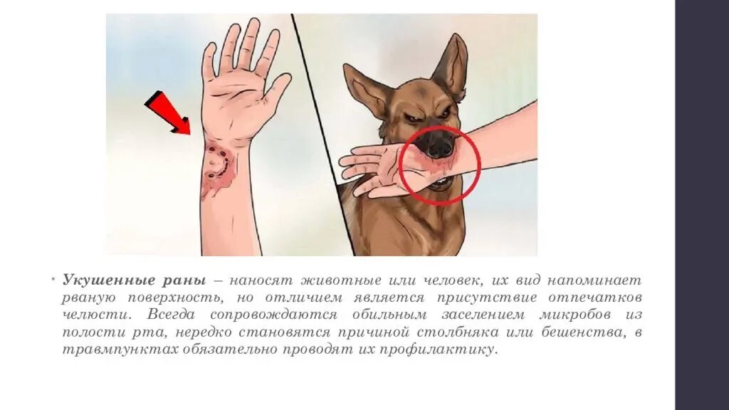 Раны после укуса собаки фото Укусила собака: что делать первая помощь, чем лечить рану, куда обращаться