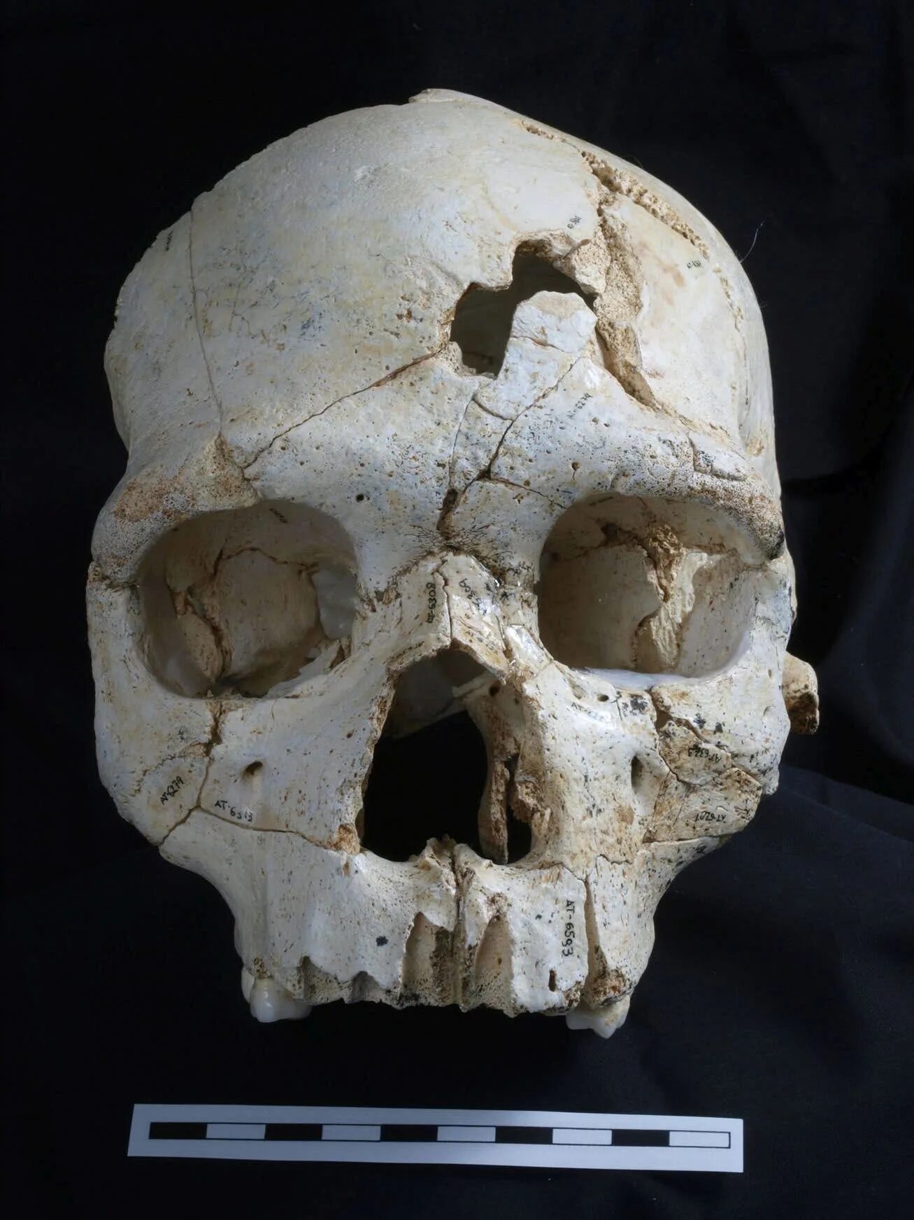 Раскололся череп у человека фото Ancient Skull Suggests an Early Murder - The New York Times