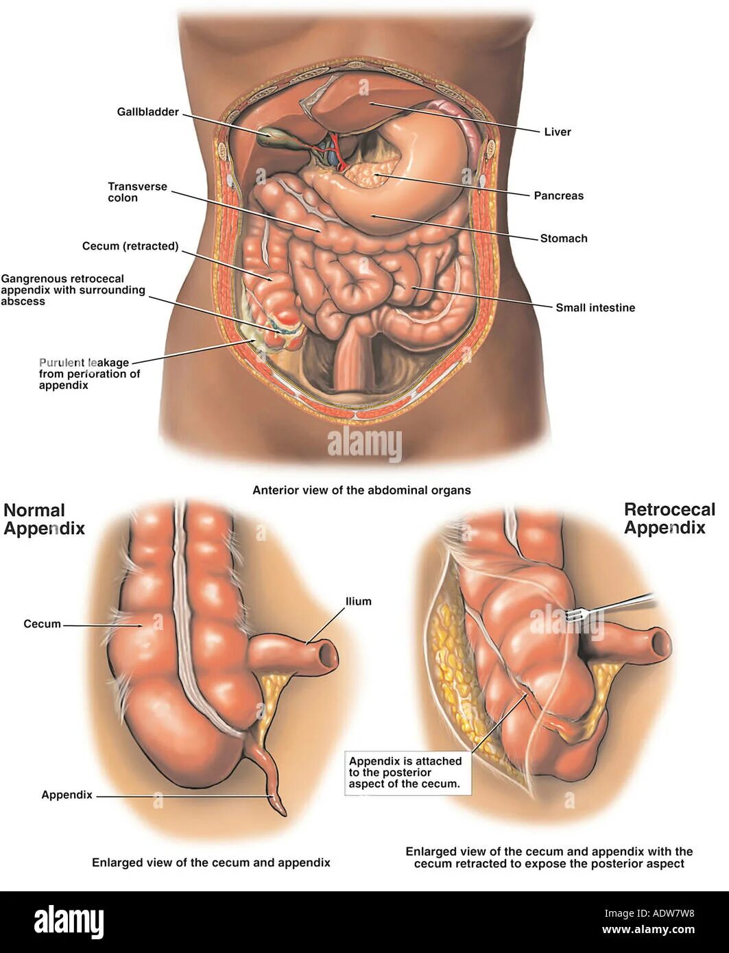 Расположение аппендицита у человека схема Large gall High Resolution Stock Photography and Images - Alamy