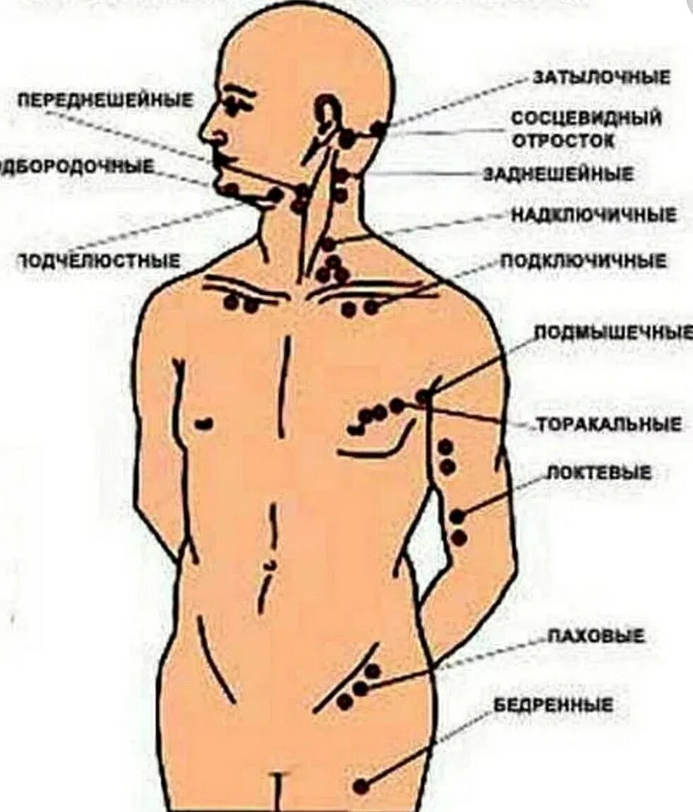 Расположение лимфоузлов на шее человека схема Наружные лимфатические узлы