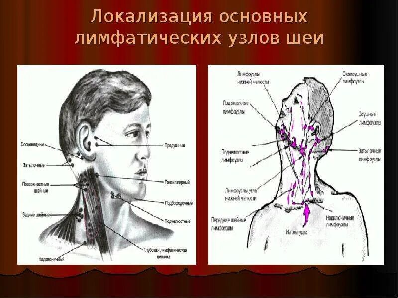 Расположение лимфоузлов на шее спереди схема Гайморит - скачать презентацию