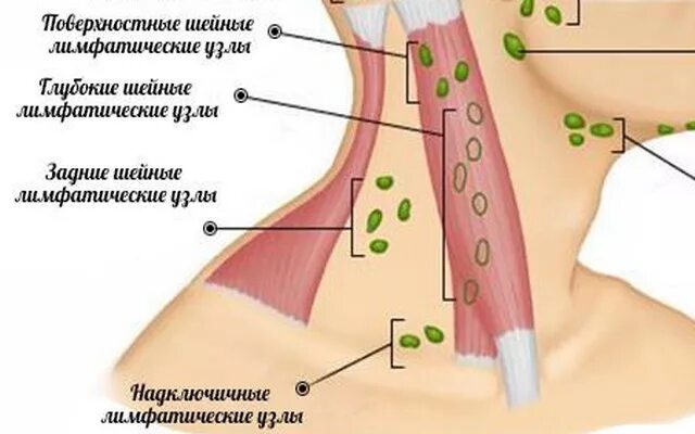 Расположение лимфоузлов на шее спереди схема Лимфатическая система при онкологии 7 путей развития рака